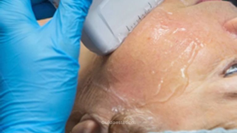 Dott. Massimo Macrì Del Giudice Quando fare HIFU e quante sedute servono