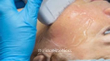 Dott. Massimo Macrì Del Giudice Quando fare HIFU e quante sedute servono