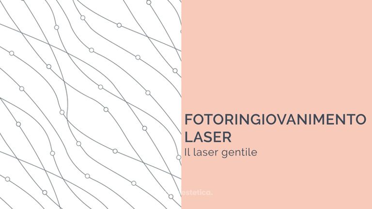 Fotoringiovanimento laser