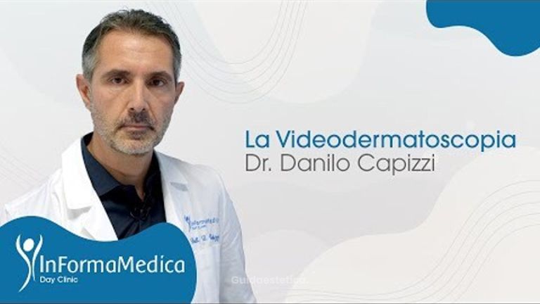 InformaMedica - La Videodermatoscopia - Dr. Danilo Capizzi