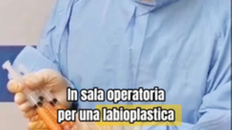 In sala operatoria labioplastica e lipofilling