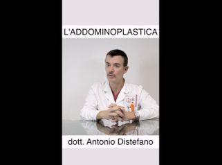 Addominoplastica