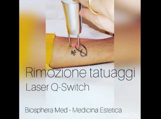 Rimozione tatuaggi - Studio medico BiospheraMed