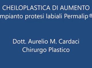 Impianto Permalip labbra - Dott. Aurelio M. Cardaci