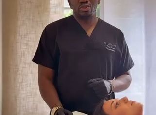 Dott. Benoit Menye Filler labbro superiore: definizione naturale