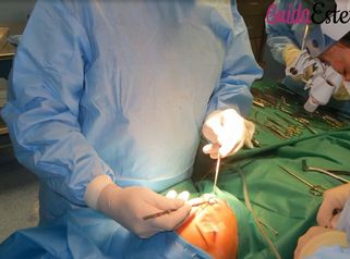 Nuove tecniche per la rinosettoplastica