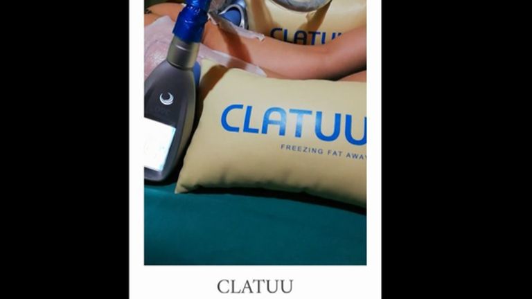 CLATUU, Crioterapia demagrimento localizzato