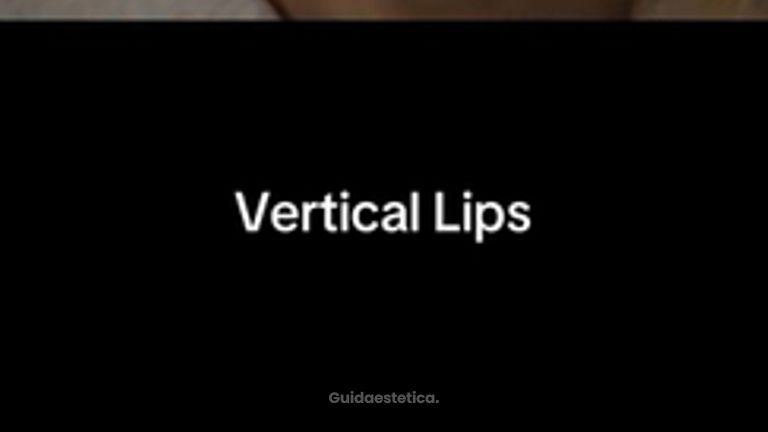Studio Medico Adigrat Risultato prima e dopo del trattamento Vertical Lips