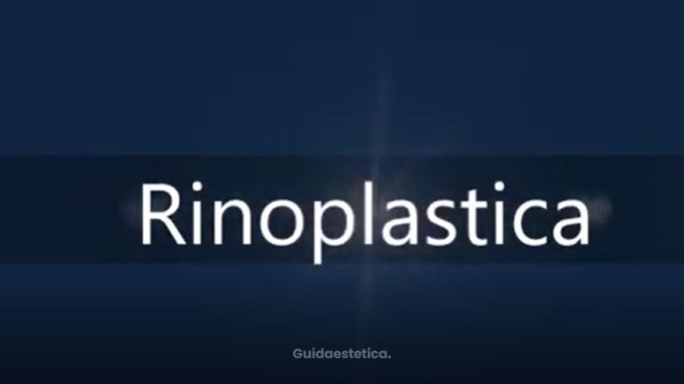 Rinoplastica