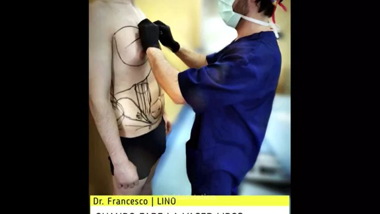 LipoVaser - Dott. Francesco Lino