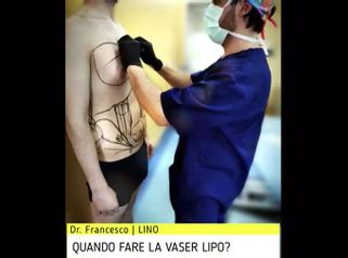 LipoVaser - Dott. Francesco Lino