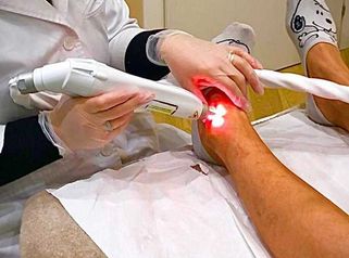 Laser vascolare per la rimozione di vasi capillari e vene Dottoressa Cornelia Florea
