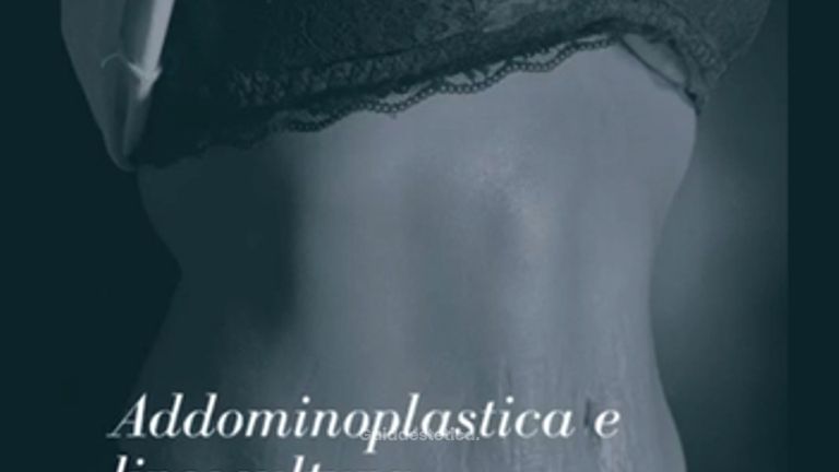 Addominoplastica - Dott. Arturo Amoroso