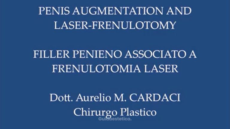 Aumento pene e frenulotomia laser - Dott. Aurelio M. Cardaci