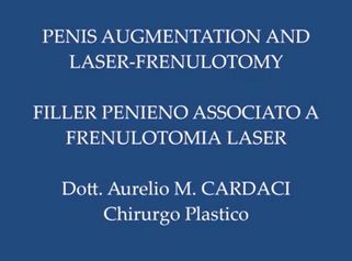 Aumento pene e frenulotomia laser - Dott. Aurelio M. Cardaci