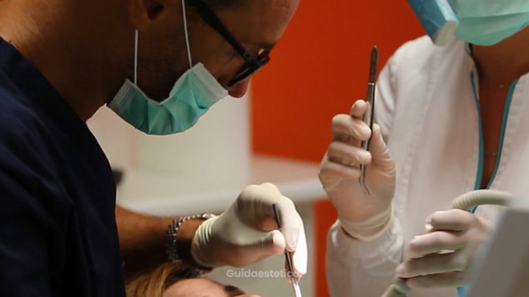 Un'estetica del viso ottimale con le faccette dentali