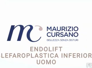 Blefaroplastica - Dott.Maurizio Cursano