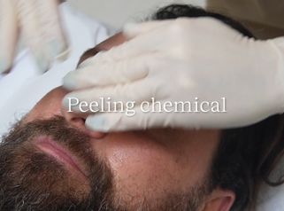 Peeling - Clinica AraMedica