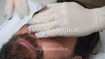 Peeling - Clinica AraMedica