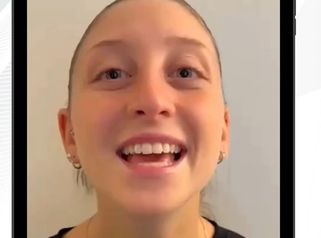 Dottor Gianluca Campiglio Rinosettoplastica: Denise racconta la sua esperienza dopo l’intervento