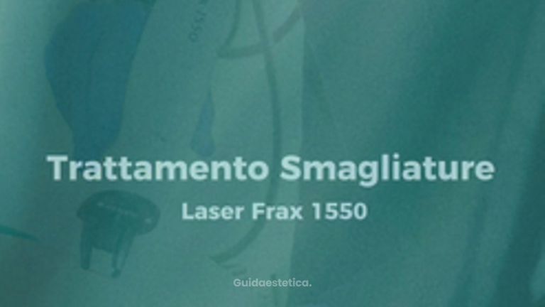 Trattamento Laser Smagliature - Clinica Deasalus - Dir. Sanitario Prof. Giorgio Maullu