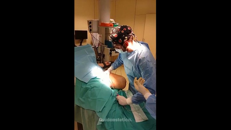 Liposuzione - Dr. Luca M. Apollini