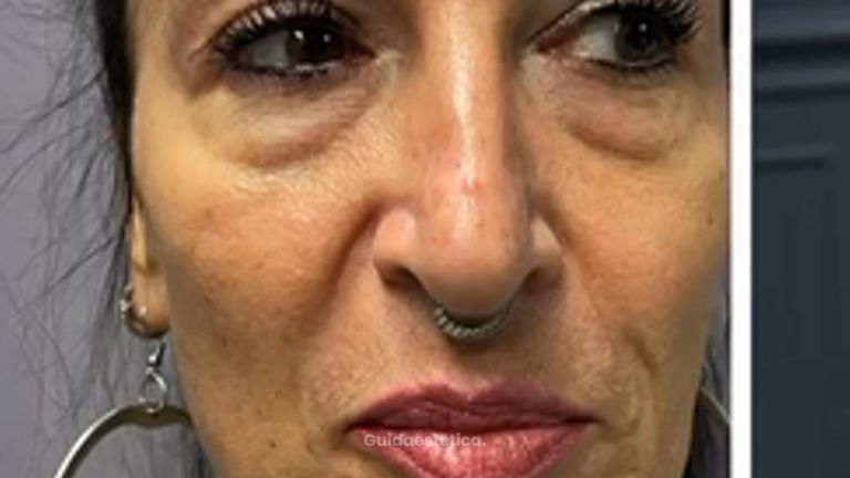 Prof. Dott. Massimiliano Giuliano Armonizzazione viso
