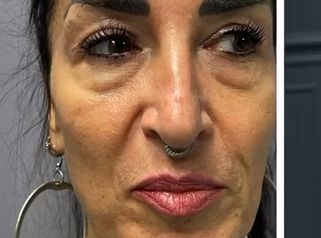 Prof. Dott. Massimiliano Giuliano Armonizzazione viso