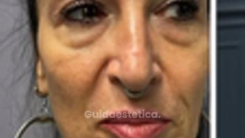 Prof. Dott. Massimiliano Giuliano Armonizzazione viso