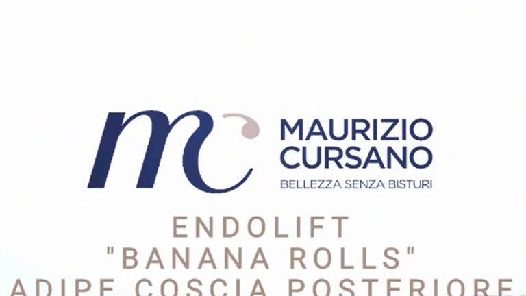 Gluteoplastia - Dott.Maurizio Cursano