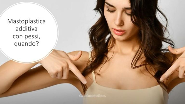Mastoplastica additiva con pessi (sollevamento seno): quando si fa? Dr Montemurro -Chirurgo Plastico