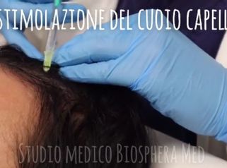 Trapianto capelli - Studio medico BiospheraMed