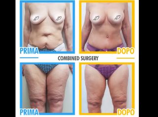 Combined surgery