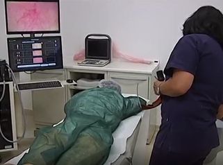 - TG PRIMA - LASER PER SCONFIGGERE I CAPILLARI Dott.ssa Lovreglio
