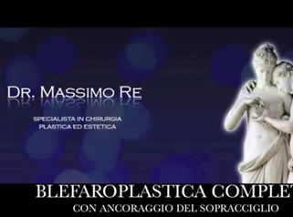 Blefaroplastica con ancoraggio del sopracciglio - Dr. Massimo Re