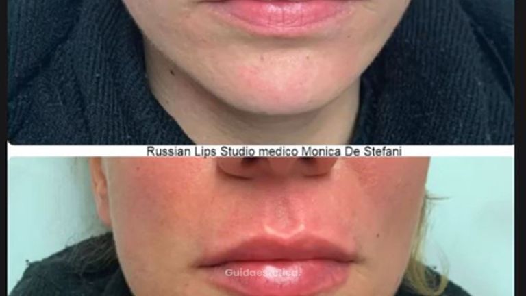 Russian Lips Studio medico Monica De Stefani