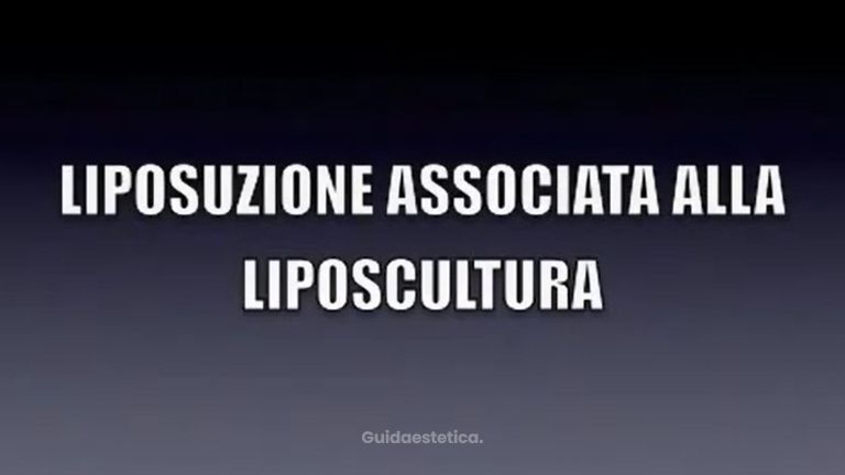 LIPOSCULTURA DR. MASSIMO RE CHIRURGO PLASTICO - LIPOSUZIONE ASSOCIATA ALLA LIPOSCULTURA