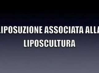 LIPOSCULTURA DR. MASSIMO RE CHIRURGO PLASTICO - LIPOSUZIONE ASSOCIATA ALLA LIPOSCULTURA