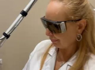 Dott.ssa Cornelia Florea  Rimozione tatuaggio di una scritta con laser Q-Switch