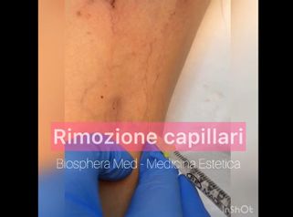 Capillari - Studio medico BiospheraMed