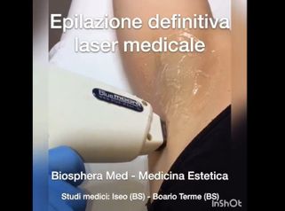 Depilazione laser - Studio medico BiospheraMed
