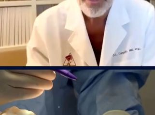 Dottor Gianluca Campiglio Mastoplastica additiva: uso delle protesi e altre tecniche