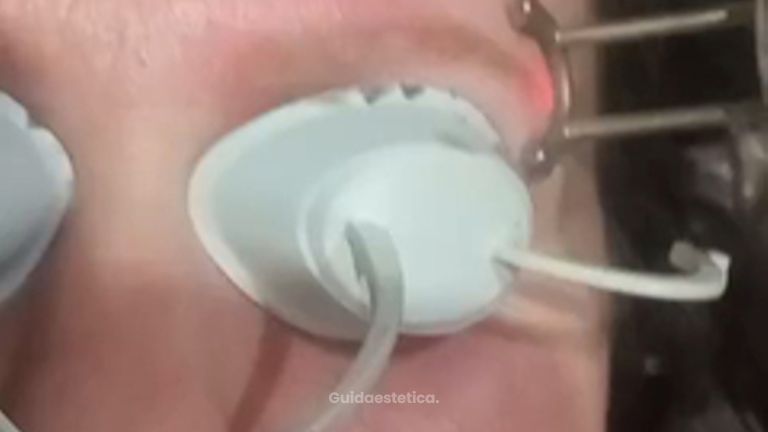 Dott.ssa Cornelia Florea Eliminazione pigmento sopracciglia