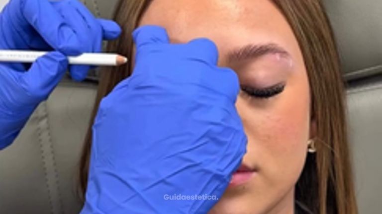 Faceland Lifting delle sopracciglia con botox