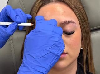 Faceland Lifting delle sopracciglia con botox