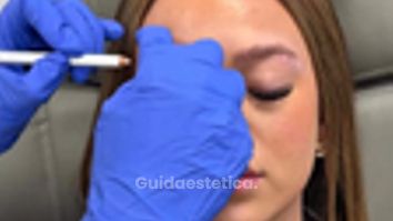 Faceland Lifting delle sopracciglia con botox