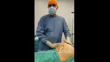 Gluteoplastica e mastoplastica additiva - Prof. Vincenzo Del Gaudio