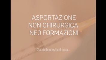 Asportazione