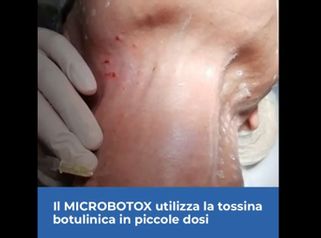 Botulino - Dott.ssa Caminiti Paola Medical SPA