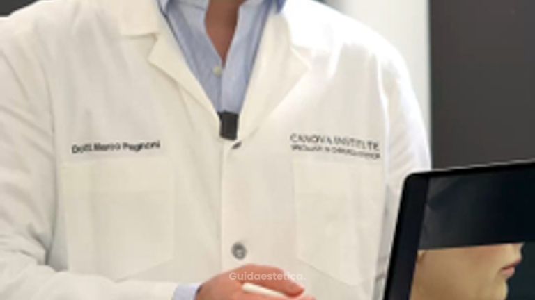 Dott. Marco Capriotti - Canova Institute Doppio mento: mini liposuzione e retrazione cutanea